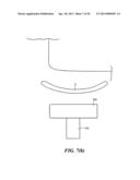 MEDICAL APPLIANCE SECURING DEVICE AND METHOD OF USING THE SAME diagram and image