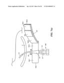 MEDICAL APPLIANCE SECURING DEVICE AND METHOD OF USING THE SAME diagram and image