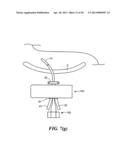 MEDICAL APPLIANCE SECURING DEVICE AND METHOD OF USING THE SAME diagram and image