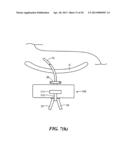 MEDICAL APPLIANCE SECURING DEVICE AND METHOD OF USING THE SAME diagram and image