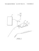 VACUUM BANDAGE PACKING diagram and image