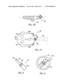 METHOD AND APPARATUS FOR PERFORMING A LESS INVASIVE SHOULDER PROCEDURE diagram and image