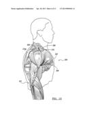 METHOD AND APPARATUS FOR PERFORMING A LESS INVASIVE SHOULDER PROCEDURE diagram and image