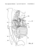 METHOD AND APPARATUS FOR PERFORMING A LESS INVASIVE SHOULDER PROCEDURE diagram and image