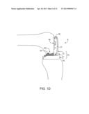 DYNAMIC KNEE BALANCER WITH FORCE OR PRESSURE SENSING diagram and image