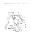 DYNAMIC KNEE BALANCER WITH FORCE OR PRESSURE SENSING diagram and image