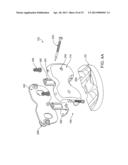 DYNAMIC KNEE BALANCER WITH FORCE OR PRESSURE SENSING diagram and image