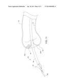 ATHERECTOMY POSITIONING DEVICE diagram and image