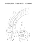 ATHERECTOMY POSITIONING DEVICE diagram and image