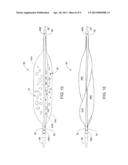 ATHERECTOMY POSITIONING DEVICE diagram and image