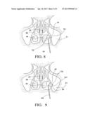 BALLOON CATHETERS AND METHODS FOR TREATING PARANASAL SINUSES diagram and image