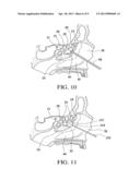 BALLOON CATHETERS AND METHODS FOR TREATING PARANASAL SINUSES diagram and image