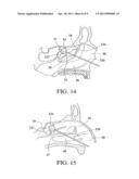 BALLOON CATHETERS AND METHODS FOR TREATING PARANASAL SINUSES diagram and image