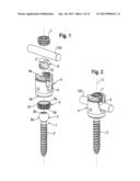 POLYAXIAL BONE ANCHORING SYSTEM diagram and image