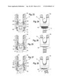 POLYAXIAL BONE ANCHORING SYSTEM diagram and image