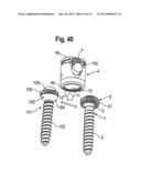 POLYAXIAL BONE ANCHORING SYSTEM diagram and image