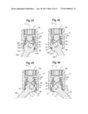 POLYAXIAL BONE ANCHORING SYSTEM diagram and image