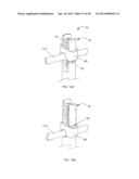 SYSTEM AND METHODS FOR CORRECTING SPINAL DEFORMITIES diagram and image