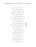 HEAT-TREATED TANTALUM-ALLOY PRODUCTS, IMPLANTABLE MEDICAL DEVICES     INCORPORATING SAME, AND METHODS OF PROCESSING TANTALUM-ALLOY PRODUCTS diagram and image