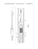 HEAT-TREATED TANTALUM-ALLOY PRODUCTS, IMPLANTABLE MEDICAL DEVICES     INCORPORATING SAME, AND METHODS OF PROCESSING TANTALUM-ALLOY PRODUCTS diagram and image