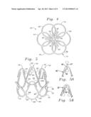 METHOD OF IMPLANTING A SELF-EXPANDABLE PROSTHETIC HEART VALVE diagram and image