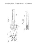 METHOD OF IMPLANTING A SELF-EXPANDABLE PROSTHETIC HEART VALVE diagram and image