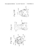 METHOD OF IMPLANTING A SELF-EXPANDABLE PROSTHETIC HEART VALVE diagram and image