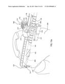 Instrumentation for repair of meniscus tissue diagram and image