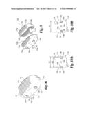 SYSTEMS AND TECHNIQUES FOR RESTORING AND MAINTAINNING INTERVERTEBRAL     ANATOMY diagram and image