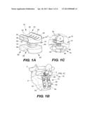 INTERSPINOUS VERTEBRAL STABILIZATION DEVICES diagram and image