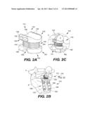 INTERSPINOUS VERTEBRAL STABILIZATION DEVICES diagram and image