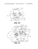 INTERSPINOUS VERTEBRAL STABILIZATION DEVICES diagram and image