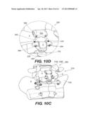 INTERSPINOUS VERTEBRAL STABILIZATION DEVICES diagram and image