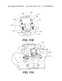 INTERSPINOUS VERTEBRAL STABILIZATION DEVICES diagram and image