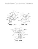 INTERSPINOUS VERTEBRAL STABILIZATION DEVICES diagram and image