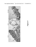 Aphicidal Toxins and Methods diagram and image