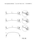 Can End Having An Annular Rib diagram and image