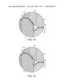 Can End Having An Annular Rib diagram and image