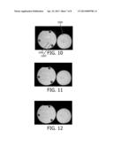 PARALLEL MAGNETIC RESONANCE IMAGING USING UNDERSAMPLED COIL DATA FOR COIL     SENSITIVITY ESTIMATION diagram and image