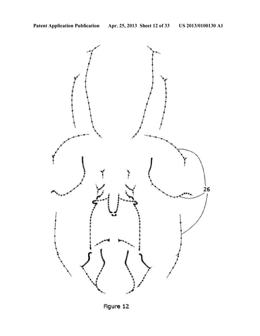 Methods and Systems for Generating and Editing Surfaces - diagram, schematic, and image 13