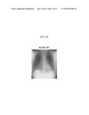 X-RAY IMAGING APPARATUS AND METHOD FOR CONTROLLING THE SAME diagram and image