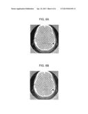 COMBINATION WEIGHT APPLIED TO ITERATIVE RECONSTRUCTION IN IMAGE     RECONSTRUCTION diagram and image