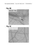 NOVEL VEGF MIMETIC PEPTIDE-BASED SCAFFOLDS FOR THERAPEUTIC ANGIOGENESIS     AND METHODS FOR THEIR USE diagram and image