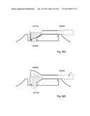 SYSTEM FOR PREPARING A COFFEE BEVERAGE, GROUND COFFEE PACKAGING CARTRIDGE     FOR USE WITH SUCH A SYSTEM, METHOD OF PREPARING A BEVERAGE BY MEANS OF     SAID SYSTEM, AND METHOD OF SUPPLYING GROUND COFFEE FROM SAID GROUND     COFFEE PACKAGING CARTRIDGE diagram and image