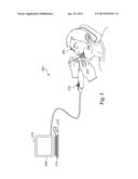 AQUEOUS COMPOSITION SUITABLE FOR INTRA-ORAL SCANNING METHODS diagram and image