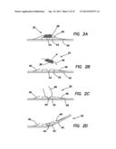 SIMULATED TISSUE STRUCTURE FOR SURGICAL TRAINING diagram and image