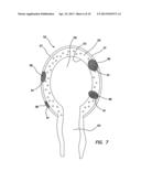 SIMULATED TISSUE STRUCTURE FOR SURGICAL TRAINING diagram and image