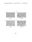 In Vitro Method for obtaining Intrahepatic Fibroblasts Infected with     Hepatitis C Virus diagram and image