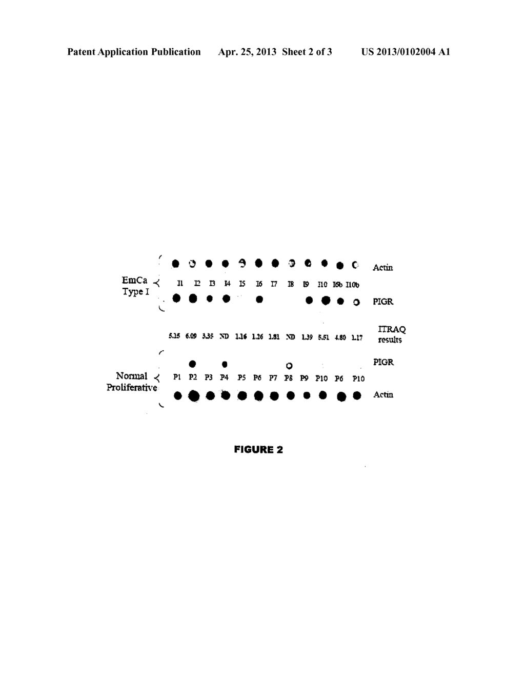 Endometrial Phase or Endometrial Cancer Biomarkers - diagram, schematic, and image 03