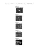 DETECTION METHOD FOR NOVEL ROS1 FUSIONS diagram and image